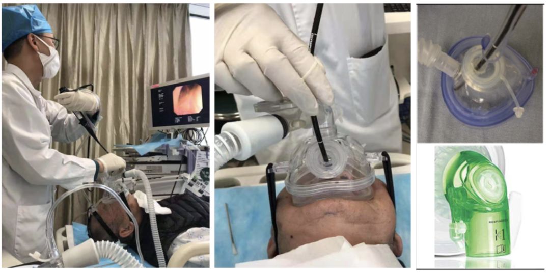 吸痰装置怎么连接【诊疗方案】新型冠状病毒感染重型及危重型患者呼吸治疗相关操作防护措施专家共识_https://www.jmylbn.com_新闻资讯_第8张