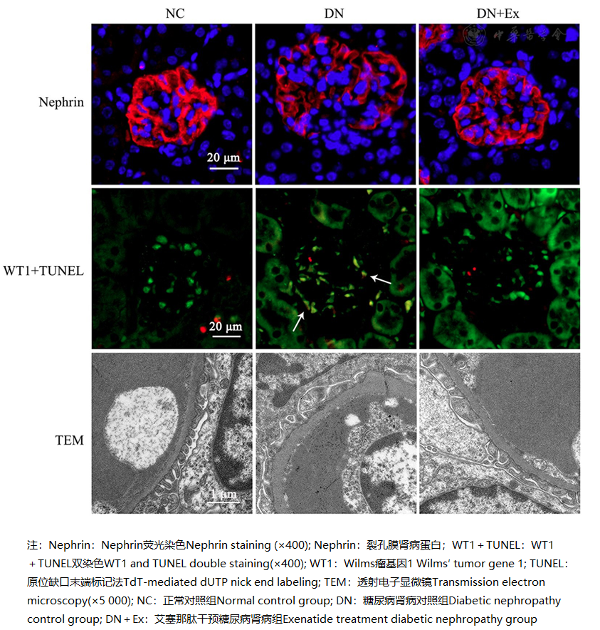 怎么使实验小鼠升血压【基础研究】艾塞那肽对糖尿病肾病小鼠足细胞的保护作用_https://www.jmylbn.com_新闻资讯_第3张
