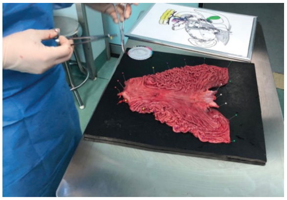 大体标本是什么【指南与共识】胃癌根治术标本的规范化外科处理中国专家共识（2022版）_https://www.jmylbn.com_新闻资讯_第25张