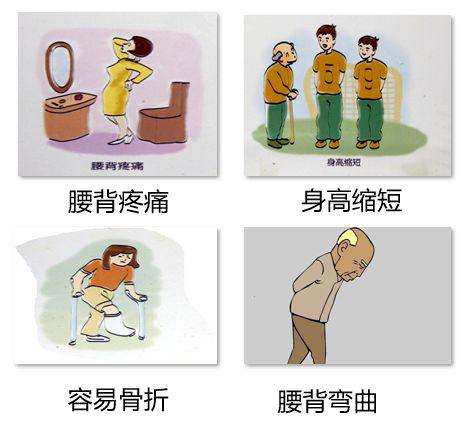 双能x骨密度检测仪为什么非得输入体重身高再添利器丨双能X射线骨密度检测仪——为您的健康“骨”把劲！_https://www.jmylbn.com_新闻资讯_第5张