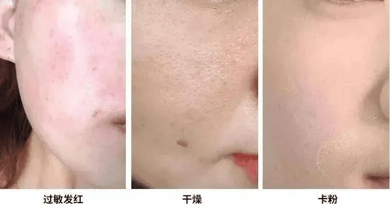 什么是光电治疗光电联合治疗——敏感肌皮肤的全新解决方案_https://www.jmylbn.com_新闻资讯_第7张