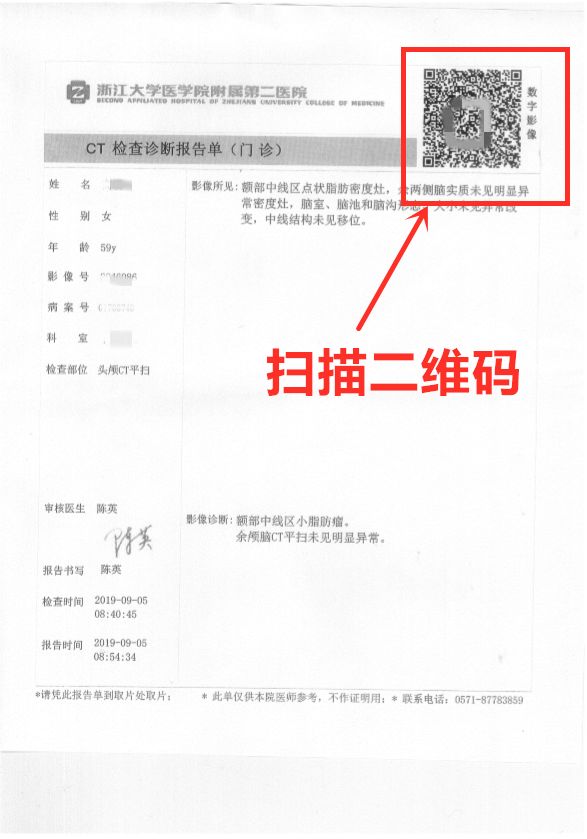 为什么x光片用胶片浙大二院上线数字影像服务— X光片“装进”手机里_https://www.jmylbn.com_新闻资讯_第9张