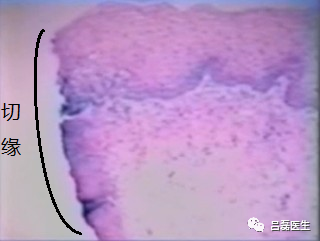 电切环怎么连接导线宫颈锥切术与LEEP术，优缺点是什么？哪个效果更好？（附具体操作方法）_https://www.jmylbn.com_新闻资讯_第11张