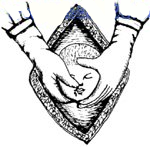 宫剪怎么样经典剖宫产术：从切开腹壁到娩出胎儿，10大操作步骤，图片讲解＞_https://www.jmylbn.com_新闻资讯_第12张