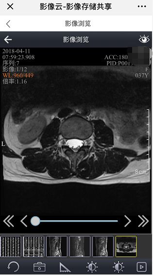 取片机怎么用便民服务丨自助打印还是电子胶片？总有一款适合你！_https://www.jmylbn.com_新闻资讯_第28张