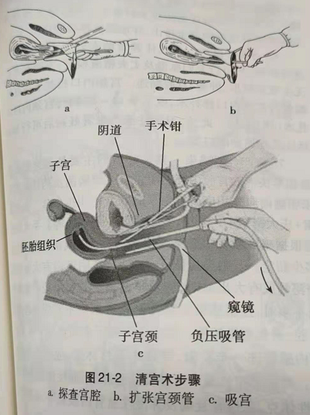 录音实锤!郑爽企图打掉孕母腹中7个月胎儿!-微信头条网 录音实锤!郑爽企图打掉孕母腹中7个月胎儿!
