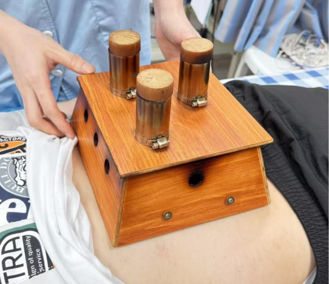 雷火灸都有什么成分【中医科特色疗法】艾灸和雷火灸——药之不及，针之不到，必须灸之_https://www.jmylbn.com_新闻资讯_第11张