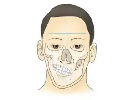 【科普】什么是大小脸？面部不对称科普