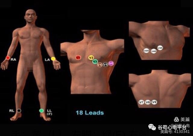 心电图mm单位怎么读12导、15导、18导连接示意图及心脏各壁超声解剖位置与心电图导联对应关系_https://www.jmylbn.com_新闻资讯_第5张