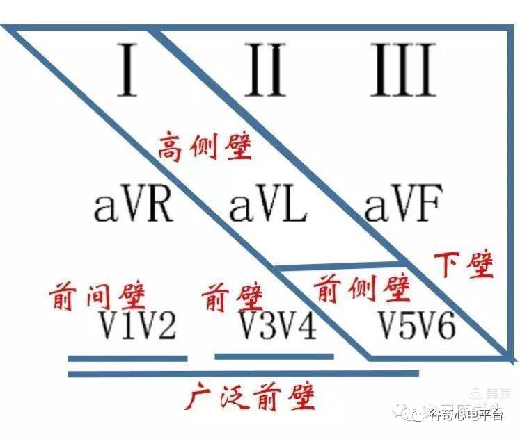 心电图mm单位怎么读12导、15导、18导连接示意图及心脏各壁超声解剖位置与心电图导联对应关系_https://www.jmylbn.com_新闻资讯_第16张