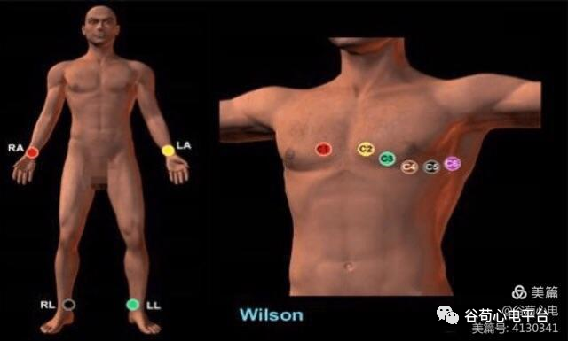 心电图mm单位怎么读12导、15导、18导连接示意图及心脏各壁超声解剖位置与心电图导联对应关系_https://www.jmylbn.com_新闻资讯_第3张