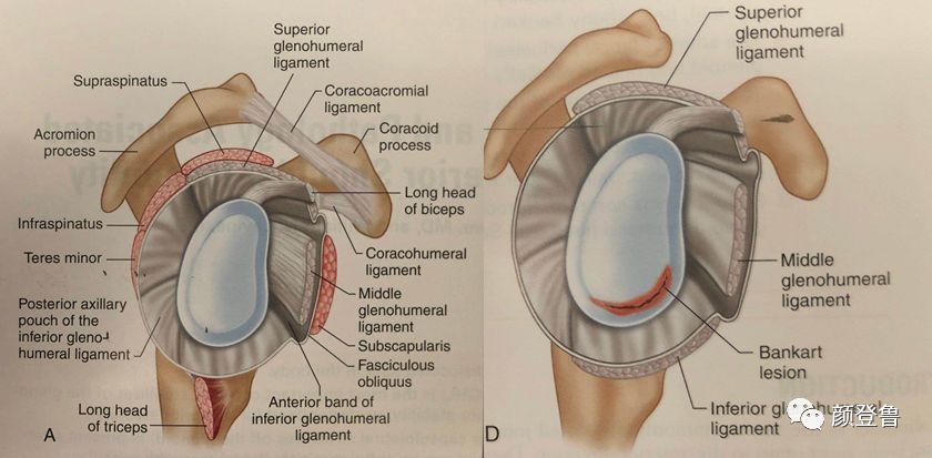 肩关节盂唇损伤的诊断和治疗