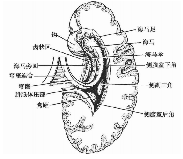 側腦室后角伸入枕葉,多呈短三稜錐形.