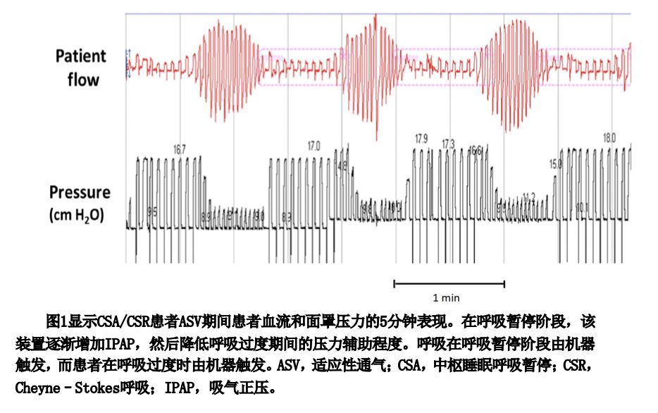 epap什么模式无创正压气道技术的进展_https://www.jmylbn.com_新闻资讯_第8张