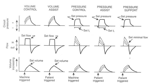 呼吸机是怎么给压力的现代呼吸机的设计特征（译文）_https://www.jmylbn.com_新闻资讯_第5张