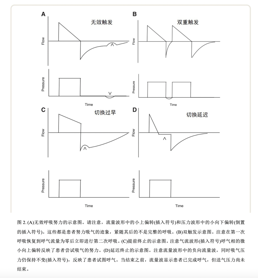 为什么呼吸机人机同步人机不同步的管理_https://www.jmylbn.com_新闻资讯_第3张