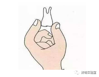 牙齿脱落，这样处理还能种回去！