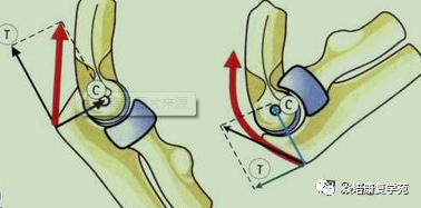 肘关节康复器怎么用肘关节疼痛及活动范围受限功能康复思路_https://www.jmylbn.com_新闻资讯_第2张