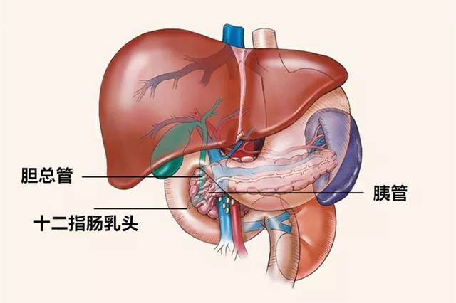 取石篮是什么小小结石  “胆”敢来犯——记平湖二院又一例ERCP微创胆道取石术_https://www.jmylbn.com_新闻资讯_第8张