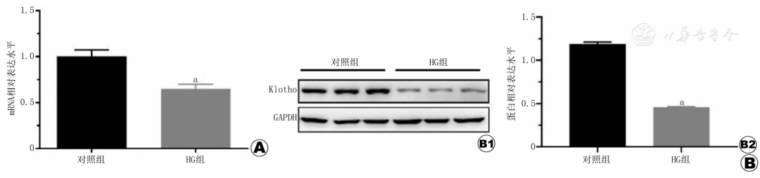 上皮细胞用什么染色Klotho促进高糖介导的人肾小管上皮细胞的自噬_https://www.jmylbn.com_新闻资讯_第1张