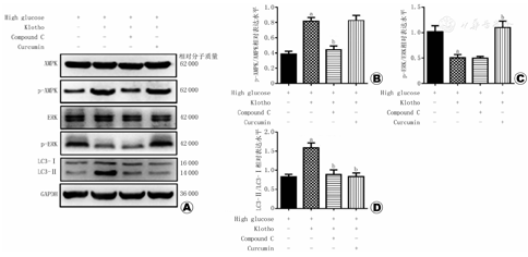 上皮细胞用什么染色Klotho促进高糖介导的人肾小管上皮细胞的自噬_https://www.jmylbn.com_新闻资讯_第5张