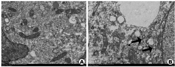上皮细胞用什么染色Klotho促进高糖介导的人肾小管上皮细胞的自噬_https://www.jmylbn.com_新闻资讯_第3张