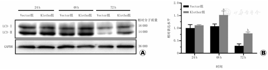 上皮细胞用什么染色Klotho促进高糖介导的人肾小管上皮细胞的自噬_https://www.jmylbn.com_新闻资讯_第2张
