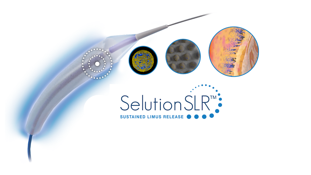cordis产品怎么样强强联合：全球血管介入巨头宣布收购知名械企_https://www.jmylbn.com_新闻资讯_第1张