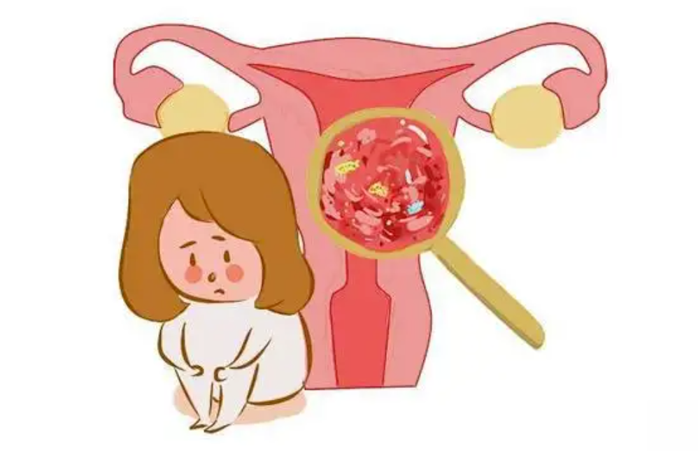 子宫内膜炎卡通图片图片