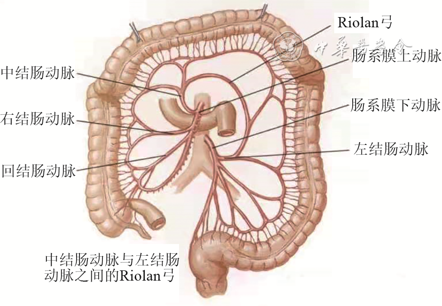 为什么要结扎血管【解剖与手术专栏】左半结肠血管解剖学的再认识及其临床意义_https://www.jmylbn.com_新闻资讯_第4张