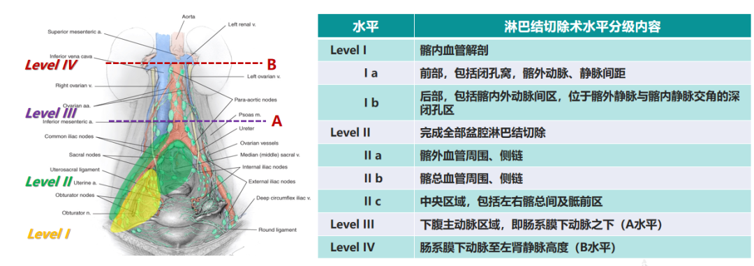 怎么使用妇科探针焦点视界丨宋坤教授：上皮性卵巢癌淋巴结切除术的必要性与临床应用_https://www.jmylbn.com_新闻资讯_第22张