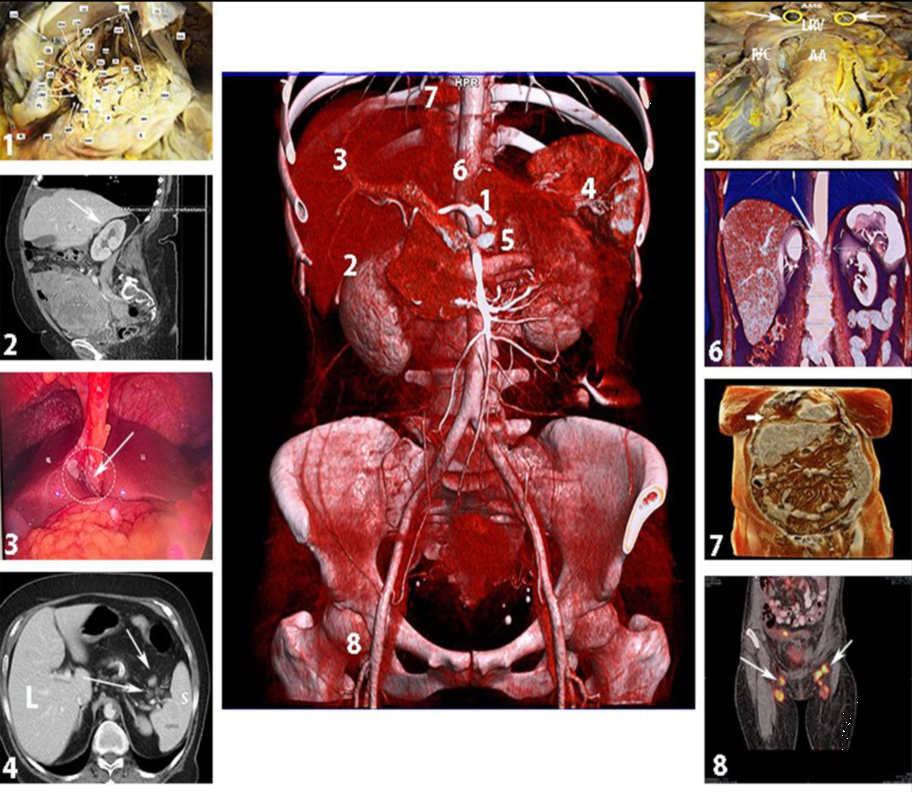怎么使用妇科探针焦点视界丨宋坤教授：上皮性卵巢癌淋巴结切除术的必要性与临床应用_https://www.jmylbn.com_新闻资讯_第20张