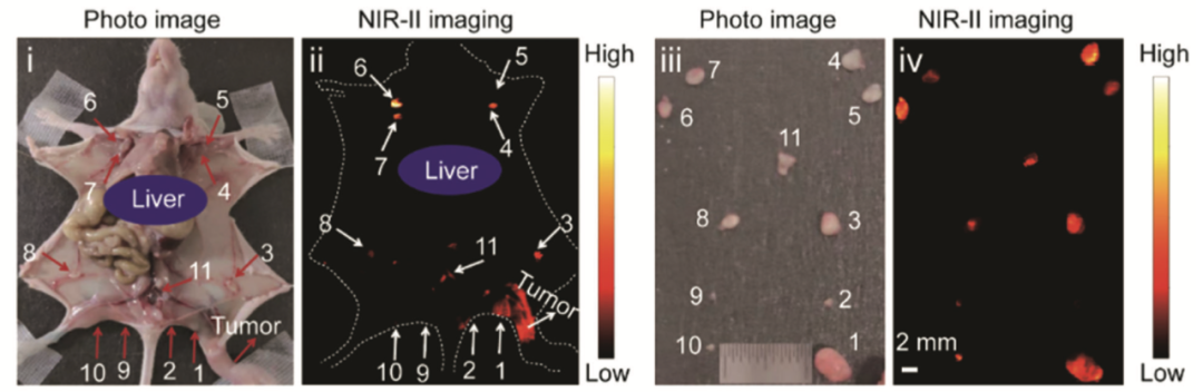 怎么使用妇科探针焦点视界丨宋坤教授：上皮性卵巢癌淋巴结切除术的必要性与临床应用_https://www.jmylbn.com_新闻资讯_第49张