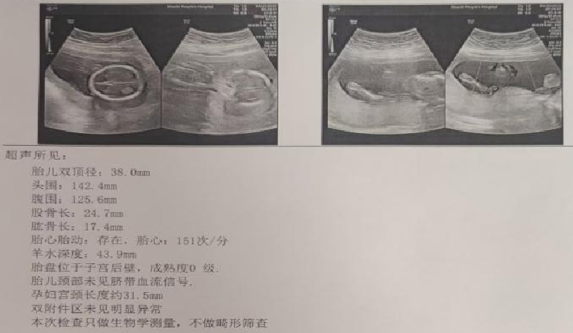 宫内镜怎么进入子宫【素手琴心专场】王素琴主任医师：妊娠期子宫蜕膜息肉的阴道内镜处理策略及时机_https://www.jmylbn.com_新闻资讯_第14张