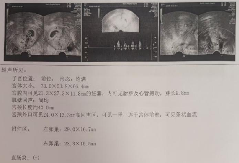 宫内镜怎么进入子宫【素手琴心专场】王素琴主任医师：妊娠期子宫蜕膜息肉的阴道内镜处理策略及时机_https://www.jmylbn.com_新闻资讯_第5张