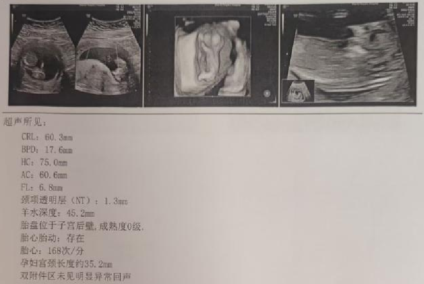 宫内镜怎么进入子宫【素手琴心专场】王素琴主任医师：妊娠期子宫蜕膜息肉的阴道内镜处理策略及时机_https://www.jmylbn.com_新闻资讯_第6张