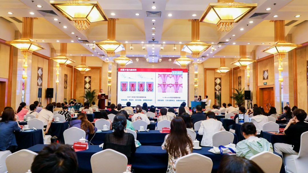 子宫内膜取样怎么取高危人群子宫内膜癌筛查多中心临床研究启动会暨子宫内膜病变临床及病理进展学术会议在京成功召开！_https://www.jmylbn.com_新闻资讯_第27张