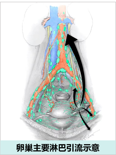 怎么使用妇科探针焦点视界丨宋坤教授：上皮性卵巢癌淋巴结切除术的必要性与临床应用_https://www.jmylbn.com_新闻资讯_第6张