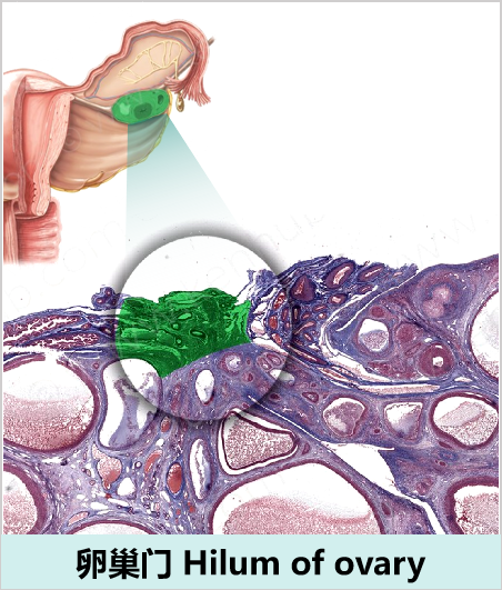 怎么使用妇科探针焦点视界丨宋坤教授：上皮性卵巢癌淋巴结切除术的必要性与临床应用_https://www.jmylbn.com_新闻资讯_第4张