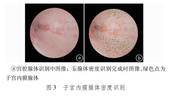 妇科器械怎么使用妇科宫腹腔镜微创技术临床应用专题丨徐大宝教授：宫腔镜技术及其应用的未来发展趋势_https://www.jmylbn.com_新闻资讯_第6张