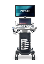 开立彩超怎么样彩超“彩”在哪儿？阿里路医疗带你认识它！_https://www.jmylbn.com_新闻资讯_第4张