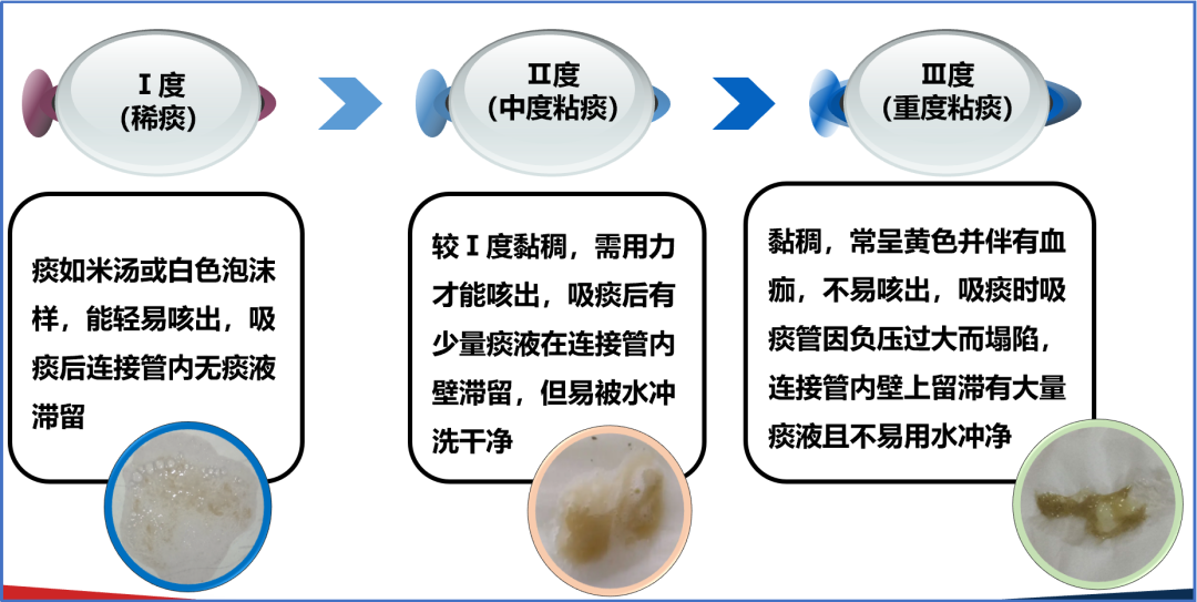 患者怎么选择人工鼻慢性意识障碍患者人工气道的管理，你需要知道这些！_https://www.jmylbn.com_新闻资讯_第17张