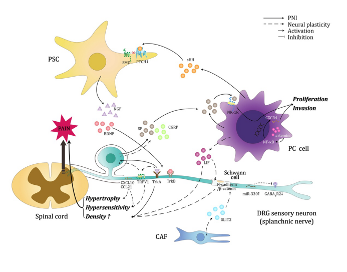 《癌痛防治》系列之-胰腺癌的疼痛治疗