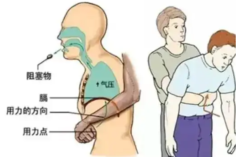 为什么要做吞咽仪器【阳光·科普】警惕老年人吃汤圆噎食！吞咽障碍早发现，教你初步自查→_https://www.jmylbn.com_新闻资讯_第11张
