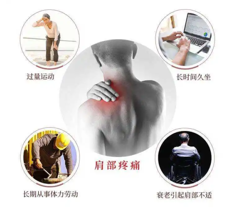 康复仪探头怎么拿【阳光·科普】小探头大作用——超声看肩周炎_https://www.jmylbn.com_新闻资讯_第3张