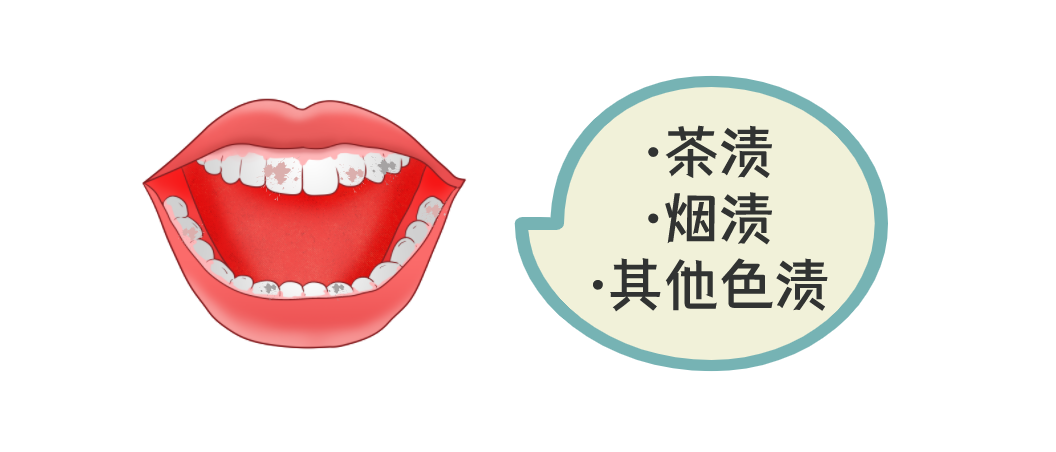 怎么选洁牙器械同样是洗牙，价格差距怎么这么大？_https://www.jmylbn.com_新闻资讯_第6张