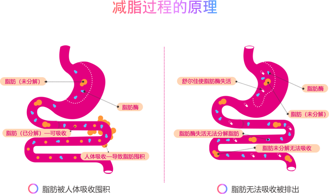 奥利司减肥药真的能减肥吗_奥利司他减肥效果怎么样_奥利司瘦身产品