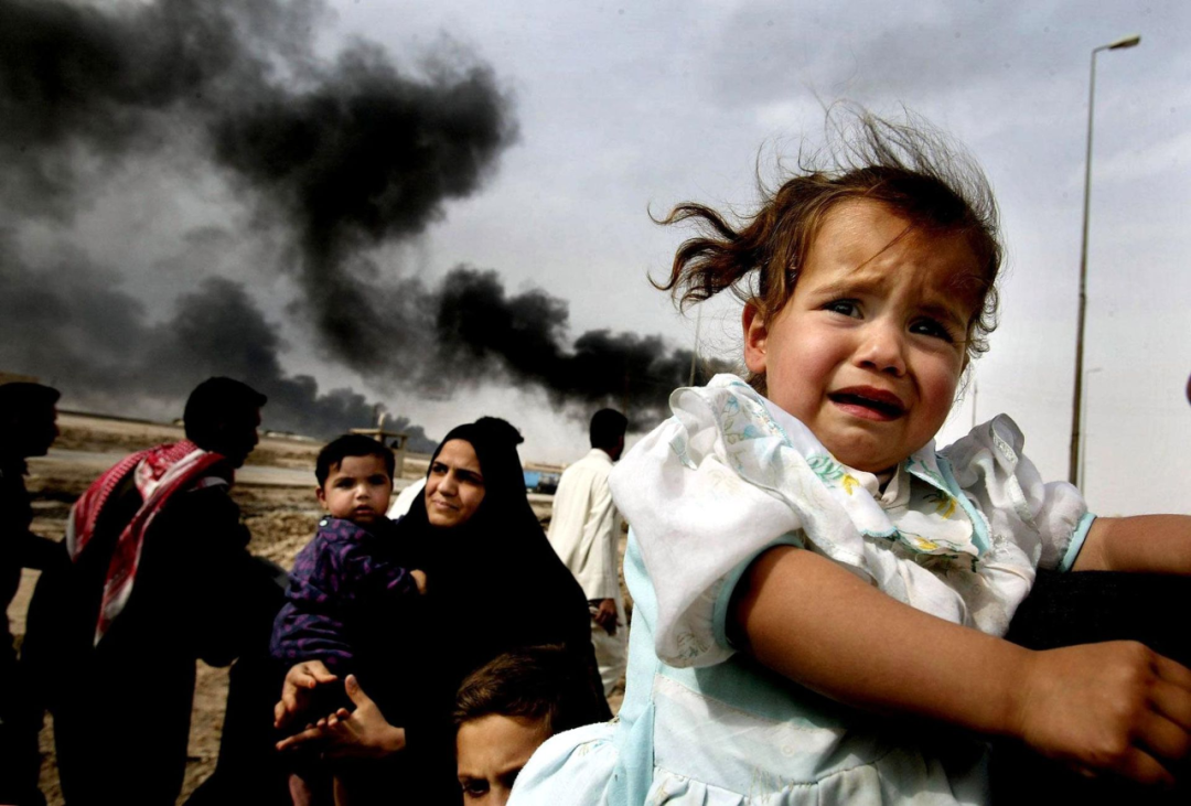 伊拉克贫铀弹儿童图片