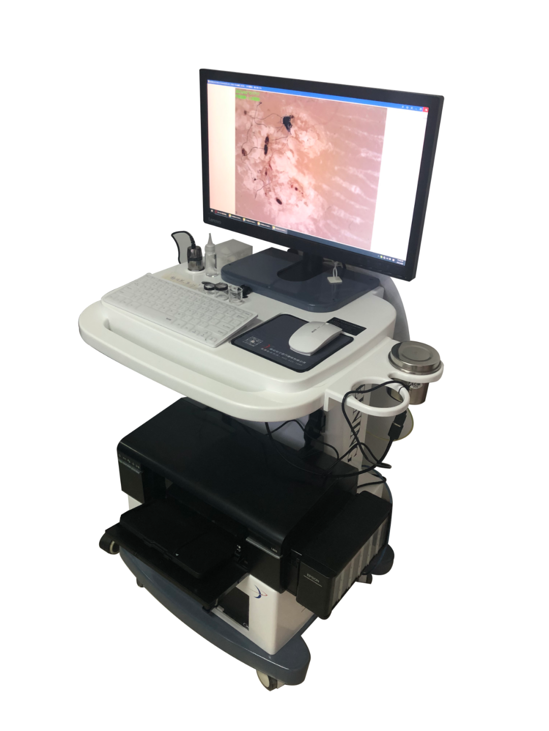 医用皮肤镜什么牌子好平原县第一人民医院皮肤科新引进皮肤镜“神器”，到底有多神奇？_https://www.jmylbn.com_新闻资讯_第2张