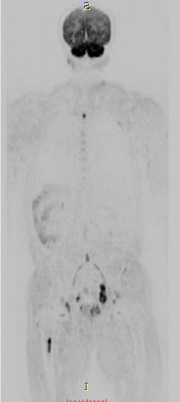 联影磁共振怎么样平原县第一人民医院联影uMR780 光梭3.0T磁共振正式投入使用，开启医学影像新时代！_https://www.jmylbn.com_新闻资讯_第18张